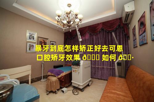 暴牙到底怎样矫正好去可恩口腔矫牙效果 🍀 如何 🌷